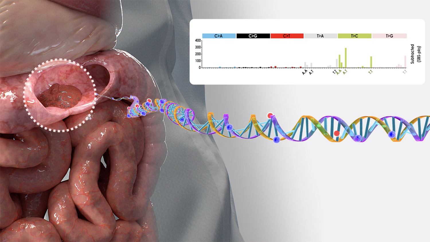 intestino DNA cancro