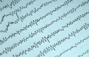 Ascoltando Mozart si riduce il rischio di crisi epilettiche