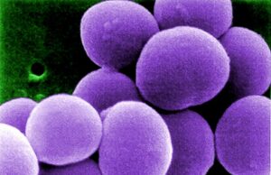 La resistenza agli antibiotici era presente già nel 1800, prima che questi farmaci fossero inventati