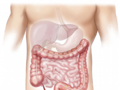 Antibiotici e diverticolite: dieci anni dopo le linee guida, le prescrizioni restano altissime. Uno studio VA rivela un problema ancora irrisolto