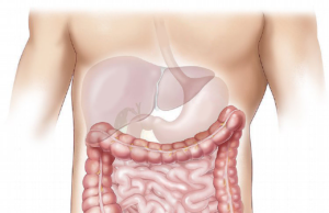 L’obesità nei giovani fa aumentare il rischio di sviluppare un carcinoma del colon-retto