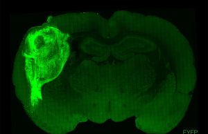 Nuovi modelli di organoidi cerebrali ottenuti da cellule staminali