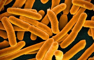 Nel 2019 le infezioni batteriche sono state la seconda causa di morte nel mondo