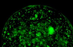 Uno strumento completamente nuovo nella cura al cancro