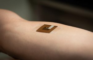 Melanoma: un cerotto per la diagnosi precoce del cancro della pelle