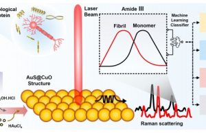 Come diagnosticare Parkinson, schizofrenia ed epilessia con una semplice goccia di saliva
